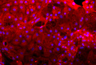 EM-COLS-SM-STEM-CYP-hiPS-HEP-cells-3382.jpg